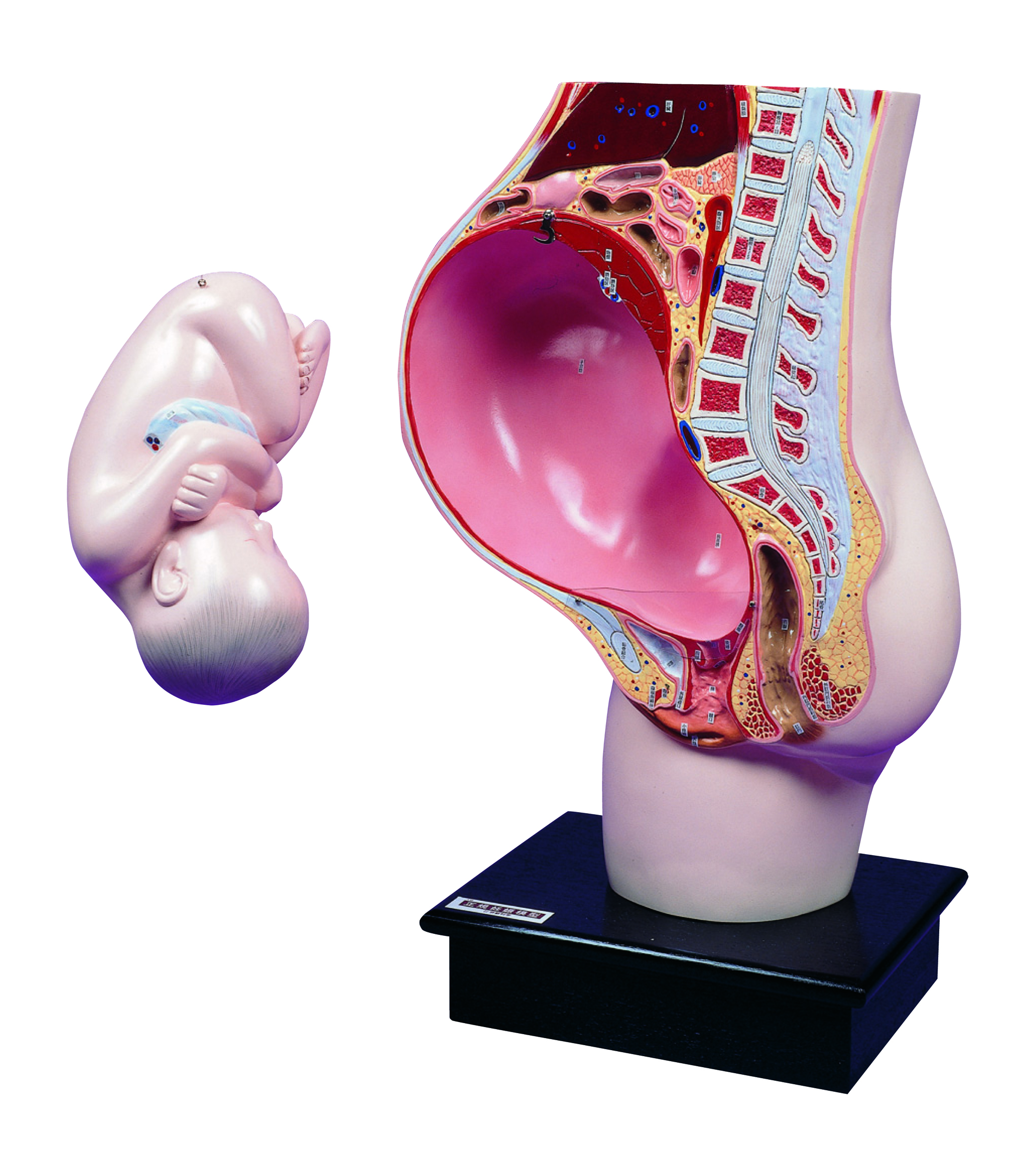 Pregnant Uterus Model