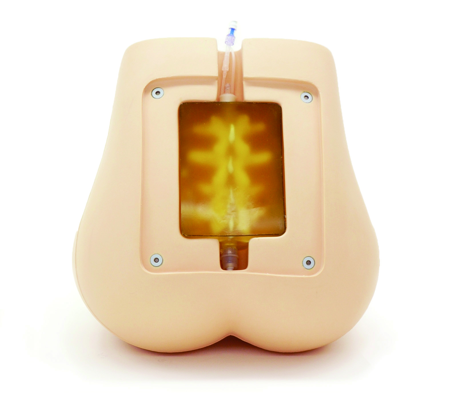 Ultrasound Compatible Lumbar Puncture/Epidural Simulator